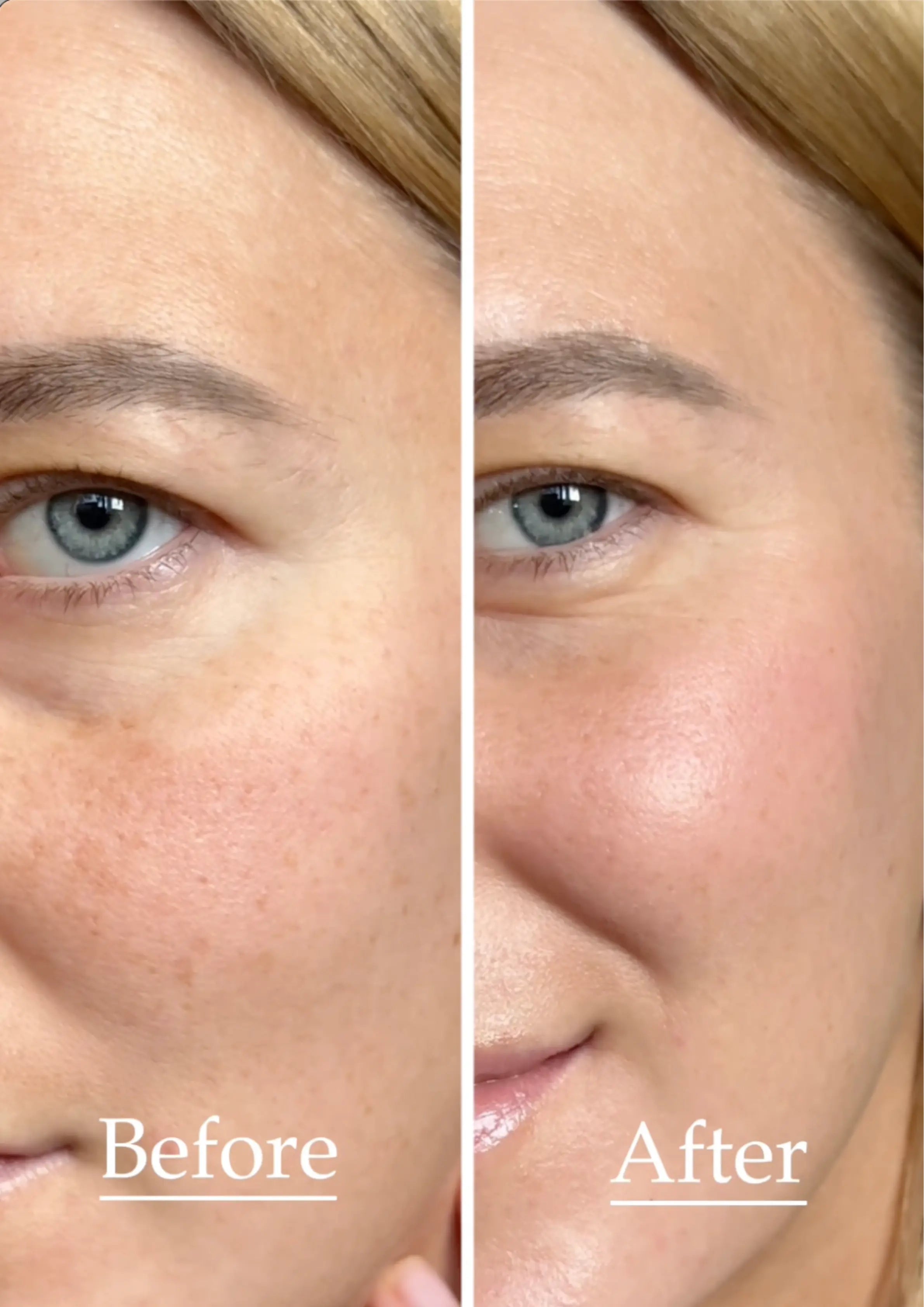 Dawn Break Moi-starter™ | Collagen Serum + Moisturiser + Primer